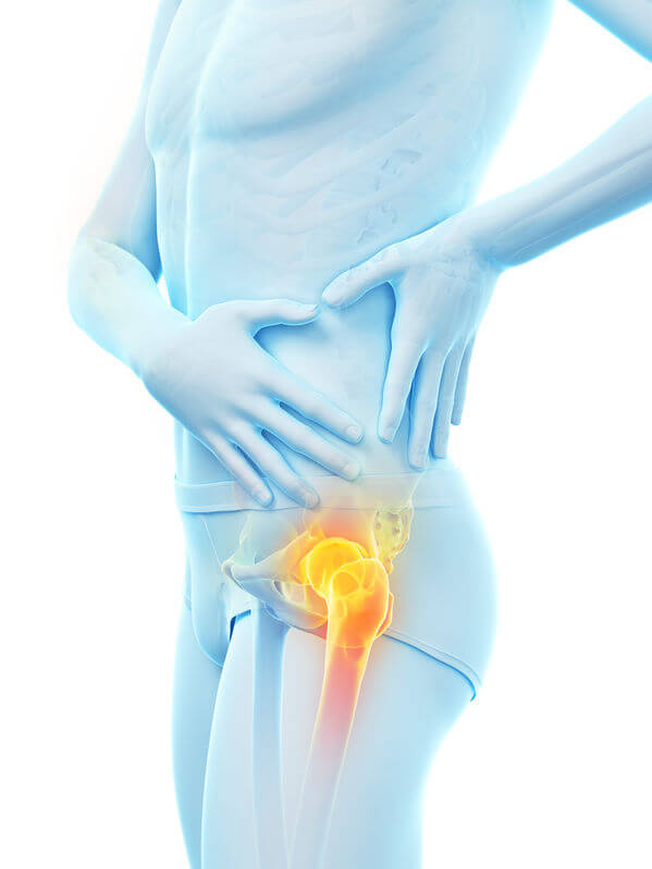 股関節　いたみ